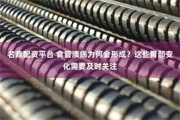 名鼎配资平台 食管溃疡为何会形成？这些胃部变化需要及时关注